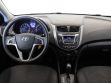Hyundai Solaris 1.4 АКПП, 2016, 83 000 км превью 12